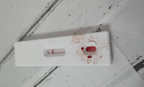 艾滋病|艾滋病试纸针头安全吗