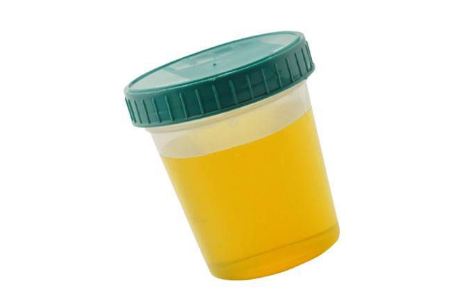 尿液|不喝水一上午就尿了4次正常吗