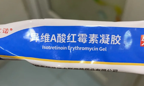 异维a酸|异维a酸红霉素凝胶形成的皮要撕掉吗