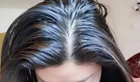 头发|头发爱出油或是因为湿气重引起的吗