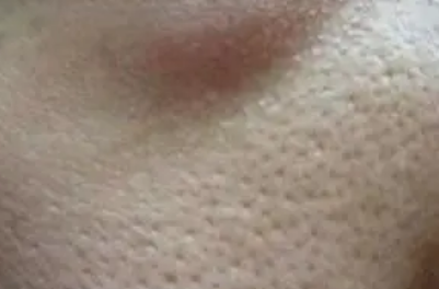 运动|运动能收缩毛孔吗